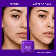 Before and after skin texture with the FreshLabs 5-Minute Power Facial