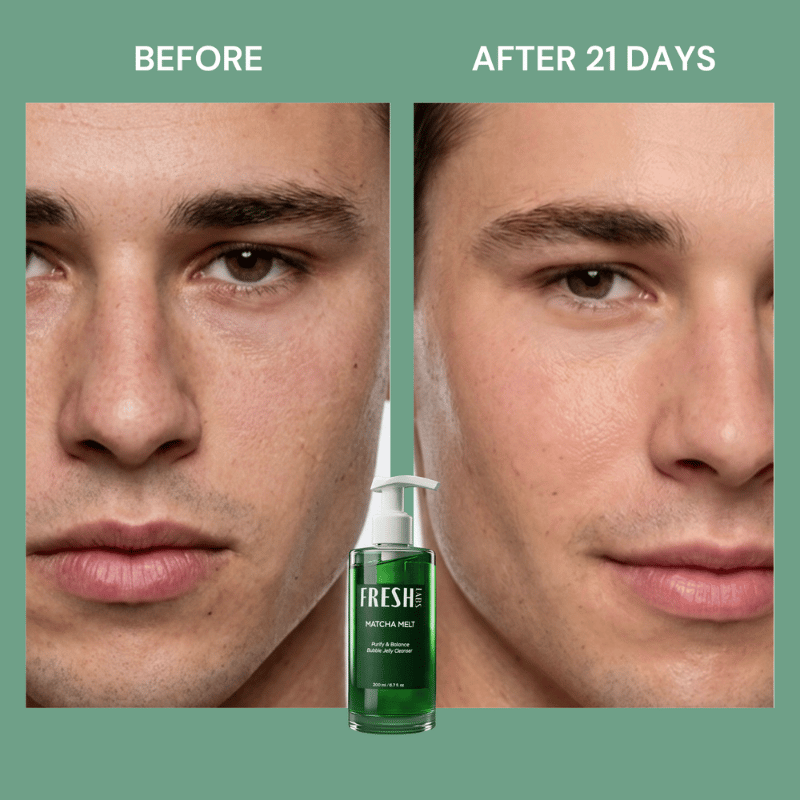Before and after pore cleansing with FreshLabs Matcha Melt Jelly Cleanser